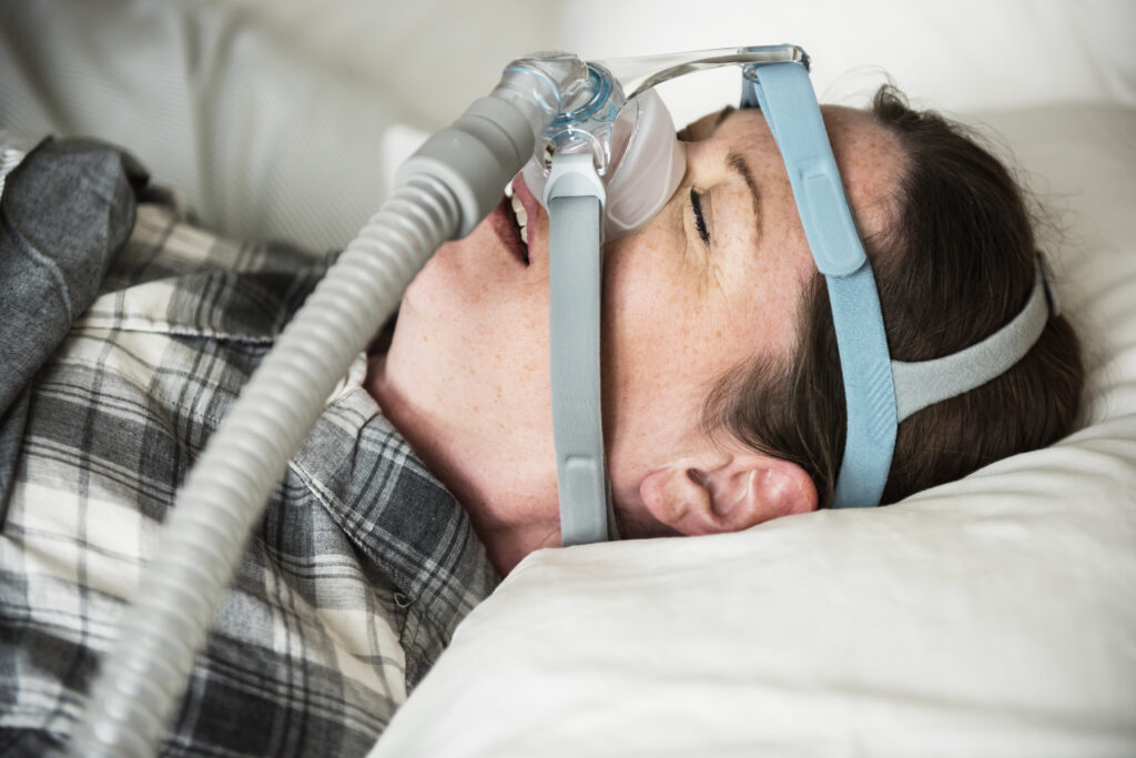 The Benefits of Bariatric Surgery for Sleep Apnea